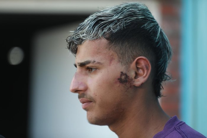 “Quando saí daquela van, já sabia que ia ser só eu”, diz atleta de Pelotas que sobreviveu a acidente com nove mortos no Paraná