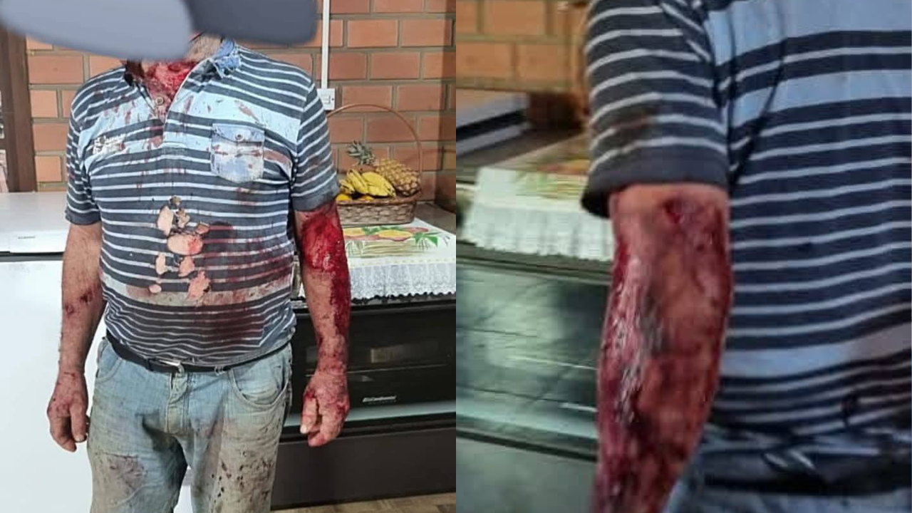 Agricultor é atacado por puma no interior de Maquiné e cão salva ao morder felino